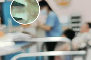苏孜阿甫片用多久有效