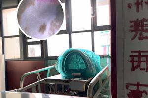 他克莫司05毫克可以代替1毫克吗