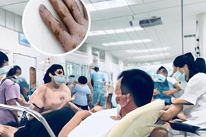 胸腺肽点滴剂的作用