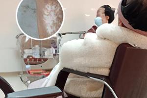 乌龙散吃完皮肤会变黑吗