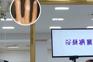 他克莫司复色过程
