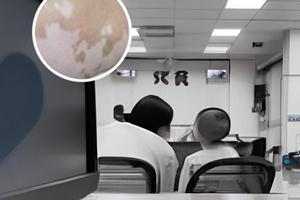 进口他克莫司和国产他克莫司区别
