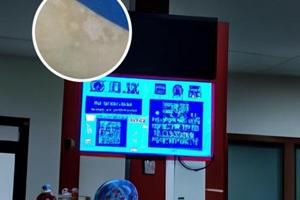 卤米松新适确得乳膏涂抹方法