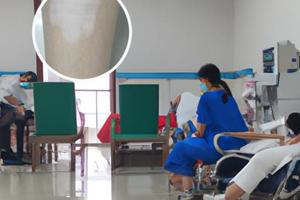 马来酸阿法替尼片怎么样