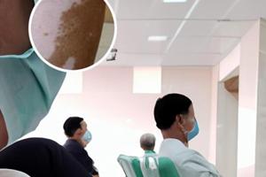 艾洛松软膏主要治什么