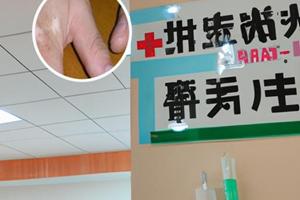 他克莫司软膏是什么颜色