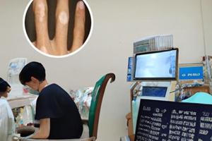 卡泊三醇软膏搽剂