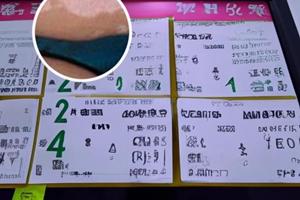 美普清盐酸丙卡特罗