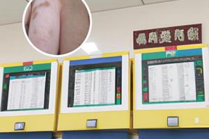 打胸腺五肽多久起效果