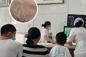 他克莫司软膏是什么样子的