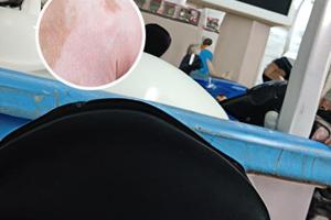 扶正散的作用是什么