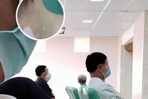匹多莫德口服液儿童用量