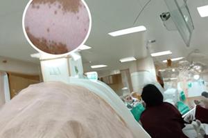 注射甲强龙会皮肤瘙痒吗
