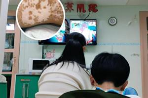 硫酸羟氯喹片是治疗什么的
