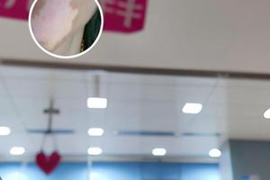 西黄丸是什么丸剂