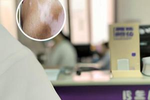 盐酸丙卡特罗片治疗什么