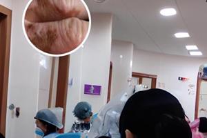 白点净白斑治疗方案