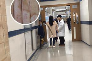 为什么医生一般不给开他克莫司