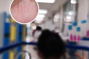 他克莫司软膏的价格为什么不一样