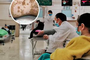 他克莫司用了一年了怎么戒断