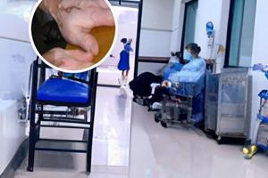 扶正散结合剂有用吗