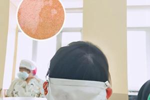 卤米松与三氯生