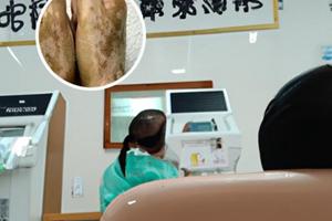白驳丸能促进黑色素生长吗