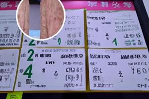 祛白酊一天涂三四次可以吗