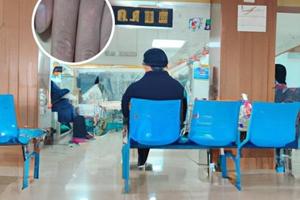 阿斯特拉他克莫司软膏怎么样