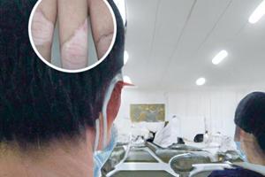 贞芪扶正颗粒功效作用与主治