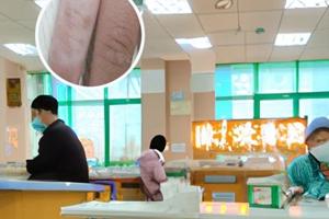 他克莫司软膏主要治疗什么病