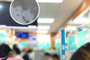 他克莫司软膏擦脸后有灼烧感