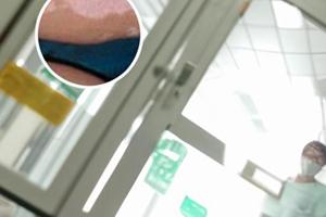 补骨脂酊治疗什么病的