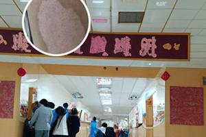喝补骨脂能治疗白癜风吗