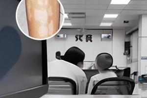 白斑保健膏怎么样好用吗