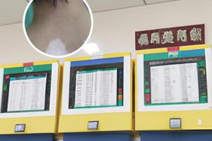 胸腺肽可以外用吗