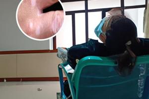 胸腺五肽针白斑可以打吗