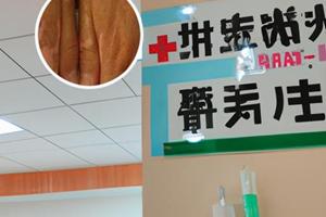 生长因子治疗白斑效果好吗