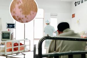 胸腺肽胶囊治什么病