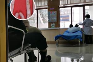 白斑抹他克莫司能好吗