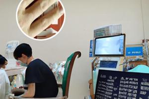 他克莫司软膏能治什么病