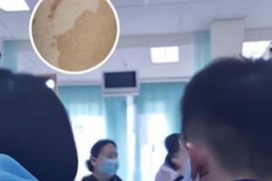 百多邦软膏功能