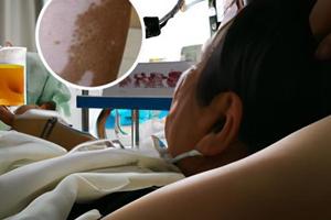 胸腺五肽打针部位