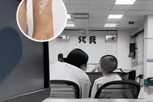吃西黄丸吃好了