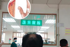 驱白巴布期片的不良反应及注意事项