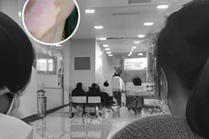 得宝松能控制白颠疯吗