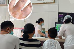 倍他米松气雾剂的作用