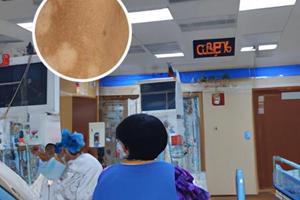 他克莫司软膏能和其他软膏一起用吗