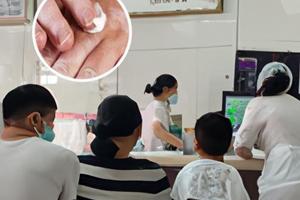 吃他克莫司的最佳时间