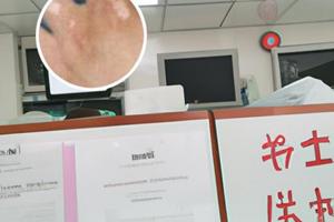 甲强龙是治疗什么的